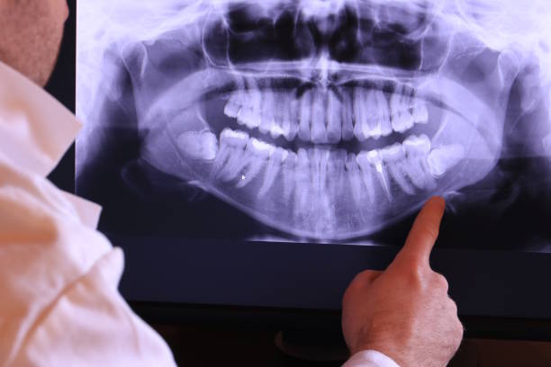 Best Urgent Dental Care in Loudonville, OH