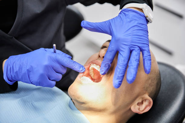 Best Emergency Tooth Extraction in Loudonville, OH