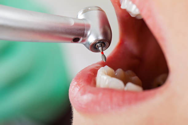 Best Pediatric Emergency Dentist in Loudonville, OH